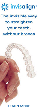 Invisalign